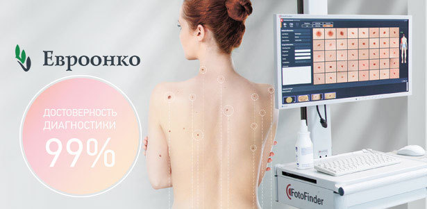 Скрининг кожи с помощью аппарата FotoFinder в клинике «Евроонко». **Скидка 30%**. Краснодар - kupikupon.ru Скрининг кожи с помощью аппарата FotoFinder в клинике «Евроонко». **Скидка 30%**