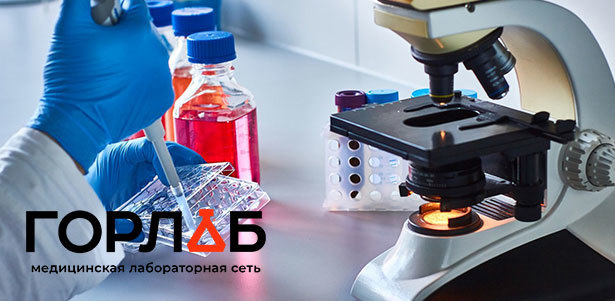 Комплексное исследование крови в медицинской лаборатории «Горлаб» на «Рассказовке»: «Биохимия крови», «Обследование щитовидной железы», «Онкологический комплекс для женщин» и не только **со скидкой 50%**
