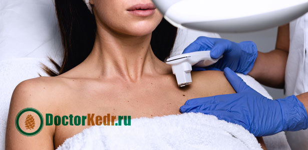 Удаление до 10 кожных новообразований в медицинском центре «Доктор Кедр». **Скидка до 90%**
