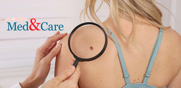 Радиоволновое удаление кожных новообразований до 8 мм на аппарате экспертного уровня Surgitron в медицинском центре Med & Care. **Скидка до 82%**